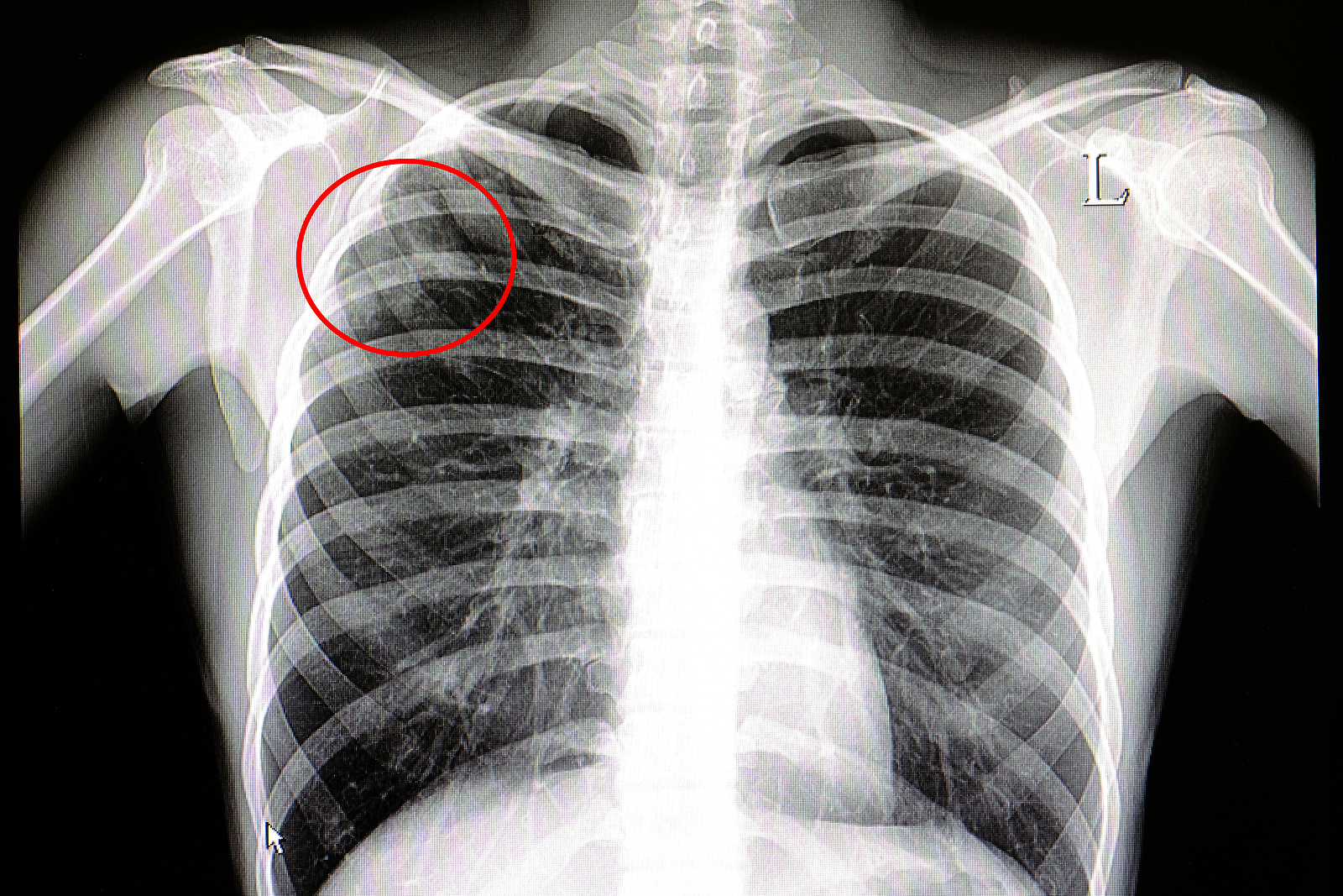 Röntgenbild eines männlichen Patienten